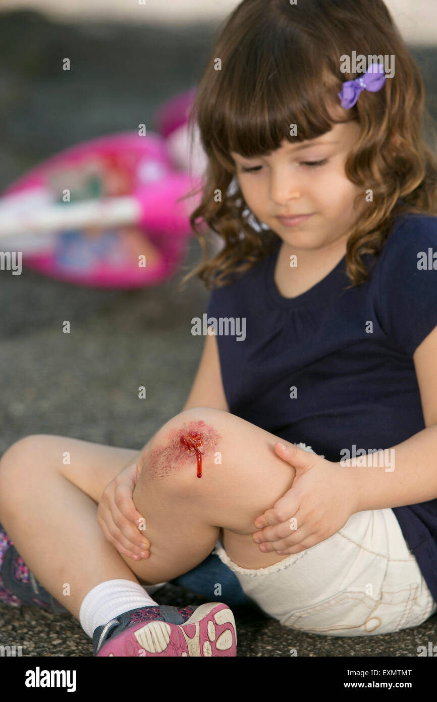 Junges Mädchen - 6-7 mit gehäutet Knie.  Dies ist ein Modell, Wunde ist fake - Make-up verwendet wurde.  -Modell veröffentlicht. Stockfoto