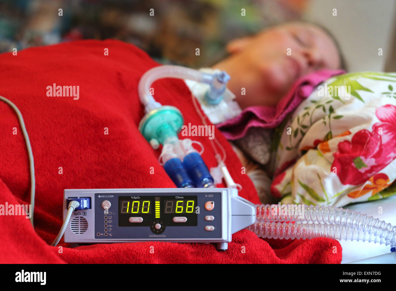 Patienten, die künstliche Beatmung wird überwacht durch eine Pulsoxymeter in einem Pflegeheim in Essen / Deutschland Stockfoto