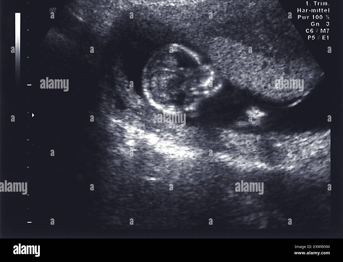 Ultraschall-Scan, Kiel, Schleswig-Holstein, Deutschland, Europa Stockfoto