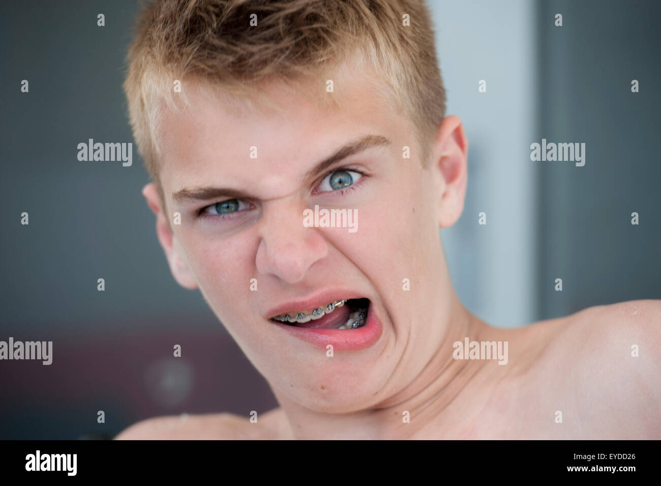 Ein Teenager mit einer Klammer in den Mund zieht lustige Gesichter Stockfoto