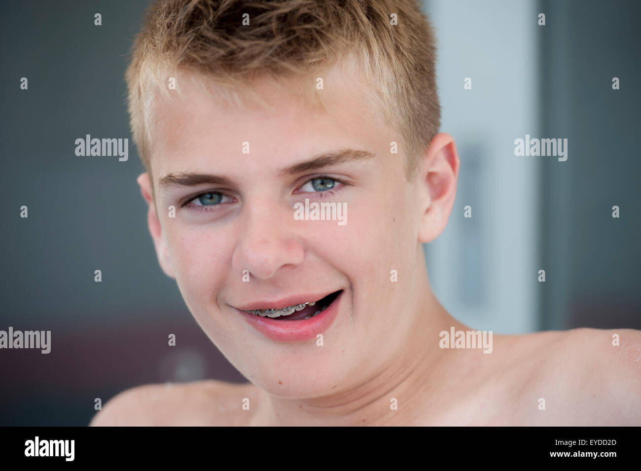 Ein Teenager mit einer Klammer in den Mund zieht lustige Gesichter Stockfoto