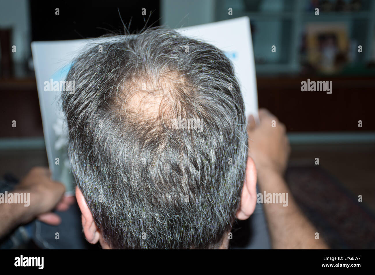 Reifer Mann, gesehen von hinten in den Kopf, um Haare zu verlieren beginnt, beginnt er zu alt zu sein. Stockfoto