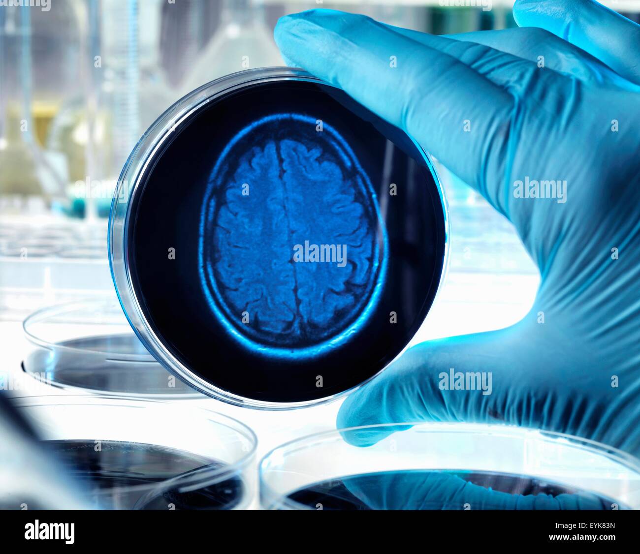Wissenschaftler halten eine Petrischale mit einem Gehirn-Scan zur Veranschaulichung Forschung in Demenz, Alzheimer und anderen Erkrankungen des Gehirns. Stockfoto