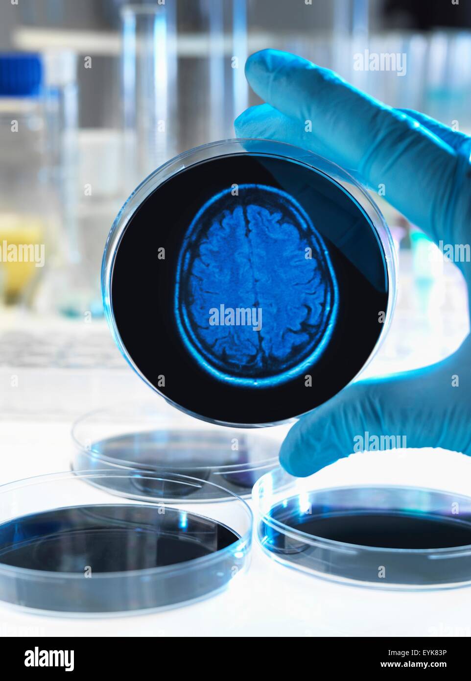 Wissenschaftler halten eine Petrischale mit einem Gehirn-Scan zur Veranschaulichung Forschung in Demenz, Alzheimer und anderen Erkrankungen des Gehirns. Stockfoto