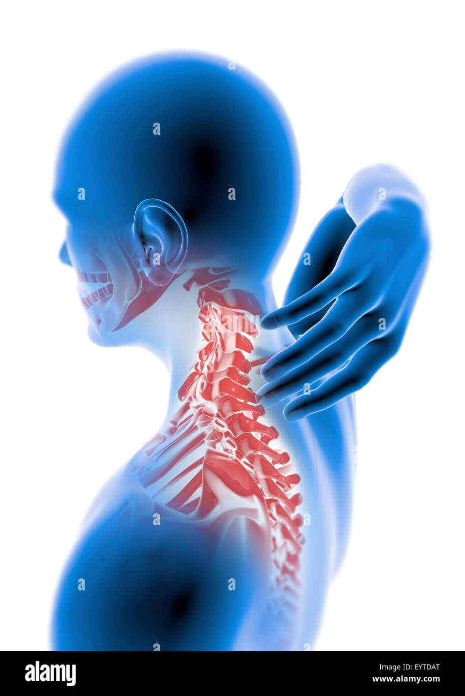 Menschlichen Röntgen mit Schmerzen im Nacken, die isoliert auf weißem Hintergrund Stockfoto