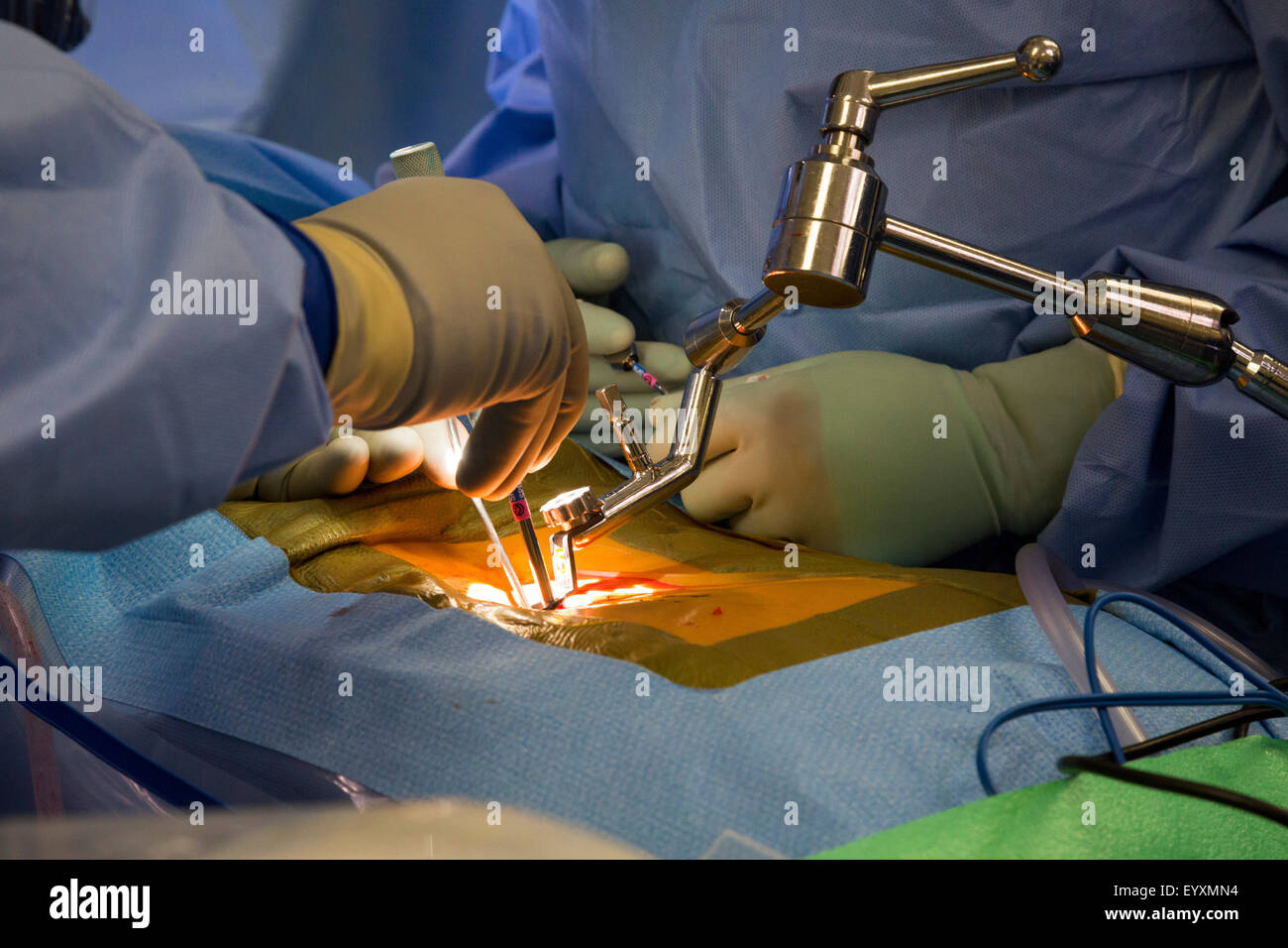 Englewood, Colorado Dr. Paul Elliott führt minimalinvasive lumbale BandscheibenOP an einem