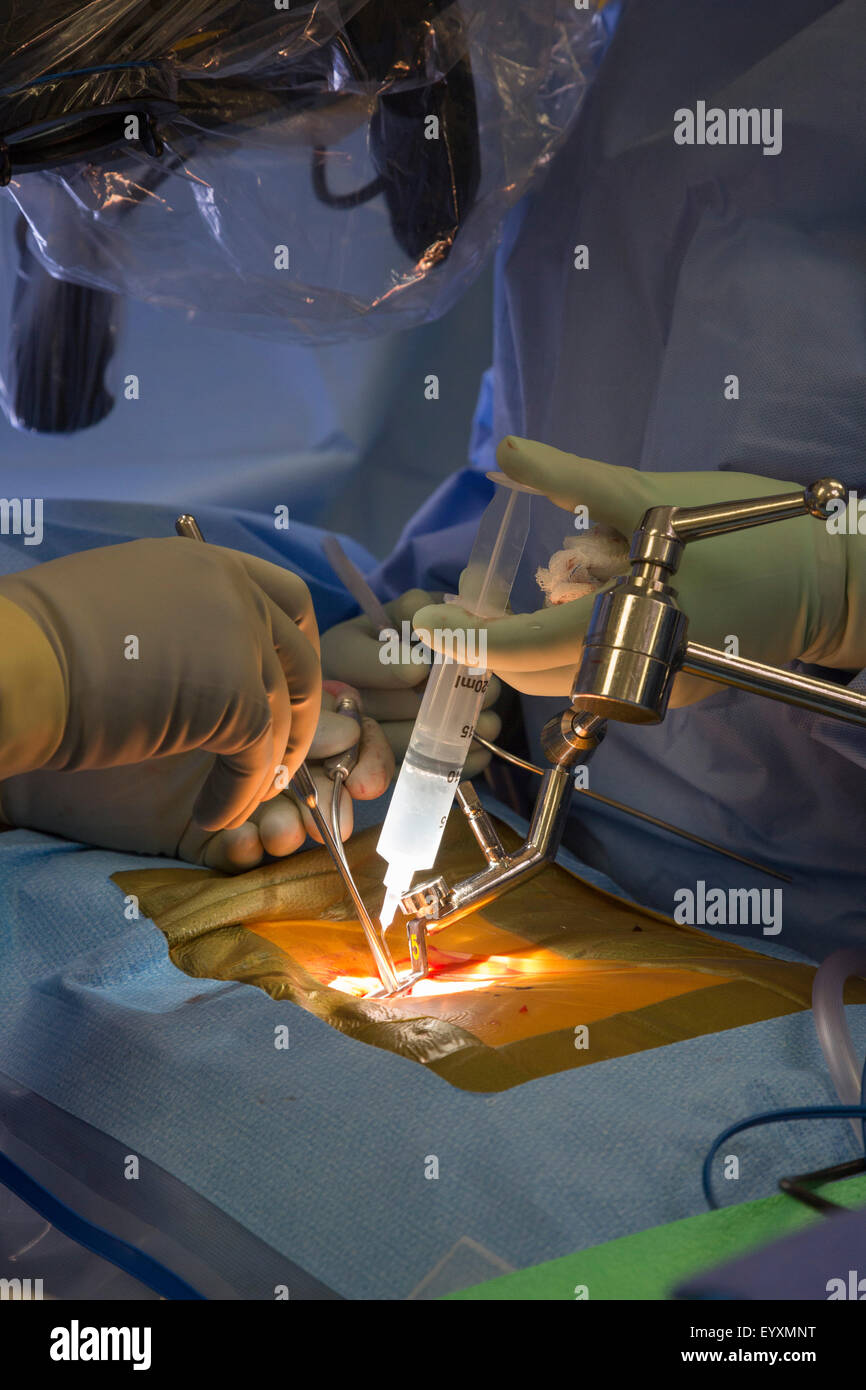 Englewood, Colorado - betäubenden Agent wird während der Operation minimal-invasive Lendenwirbelsäule in einen Muskel injiziert. Stockfoto