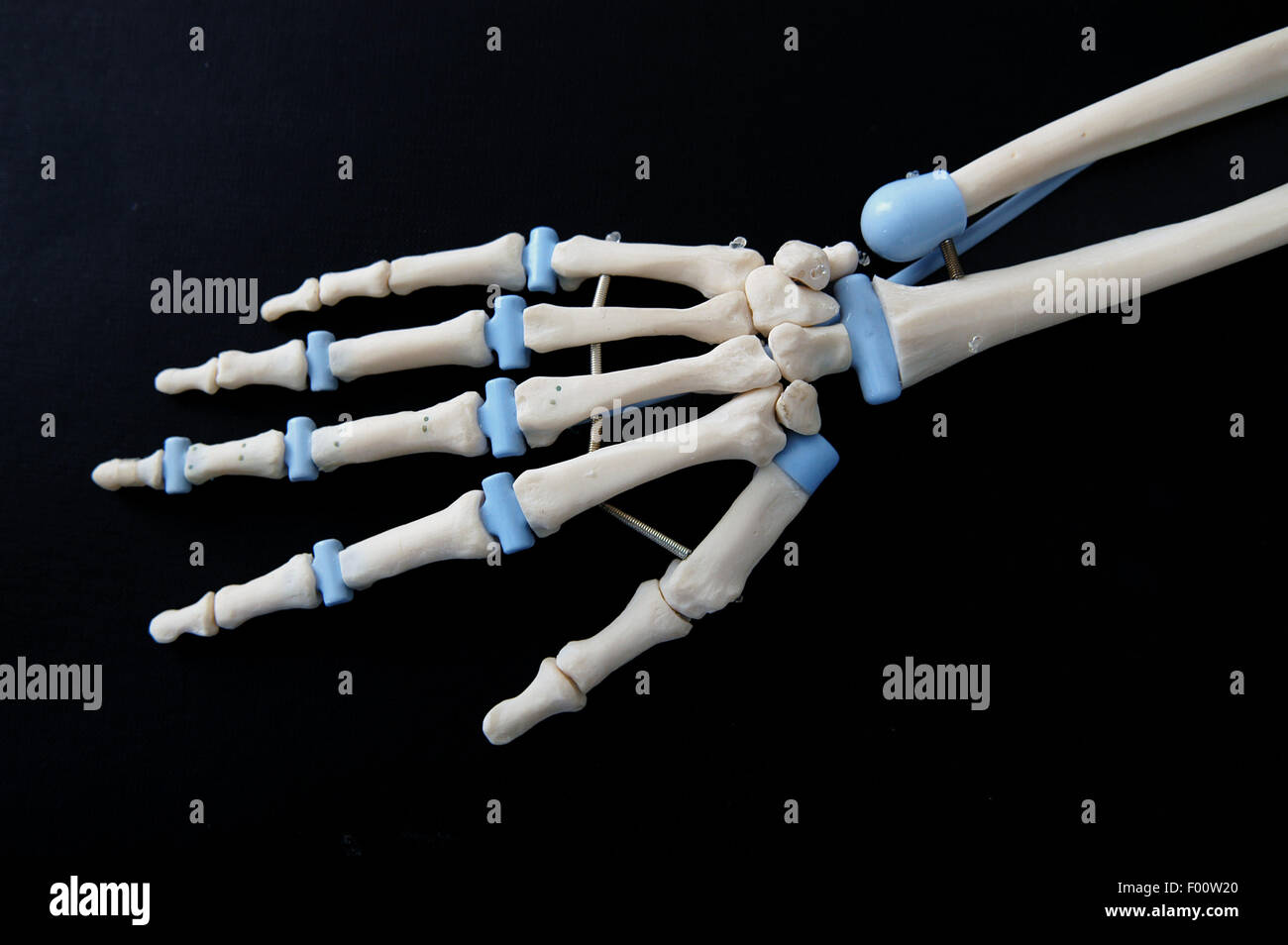 Die Hersteller von orthopädischen Institut Galeazzi (Mailand, Italien), Prothese von Hand Ligamentum Stockfoto