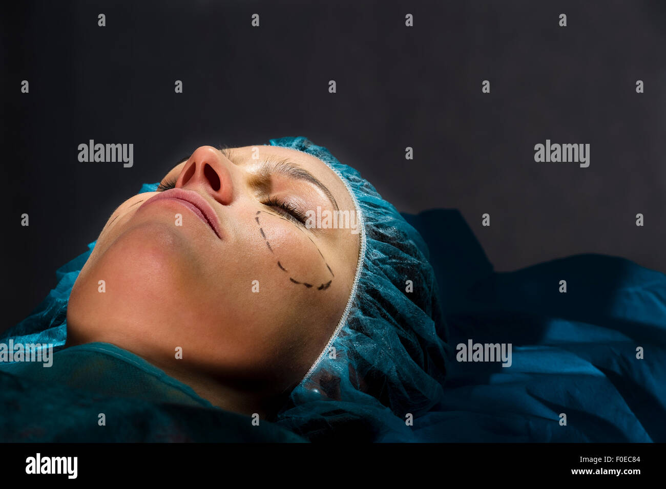 Frau in plastische Chirurgie Stockfoto
