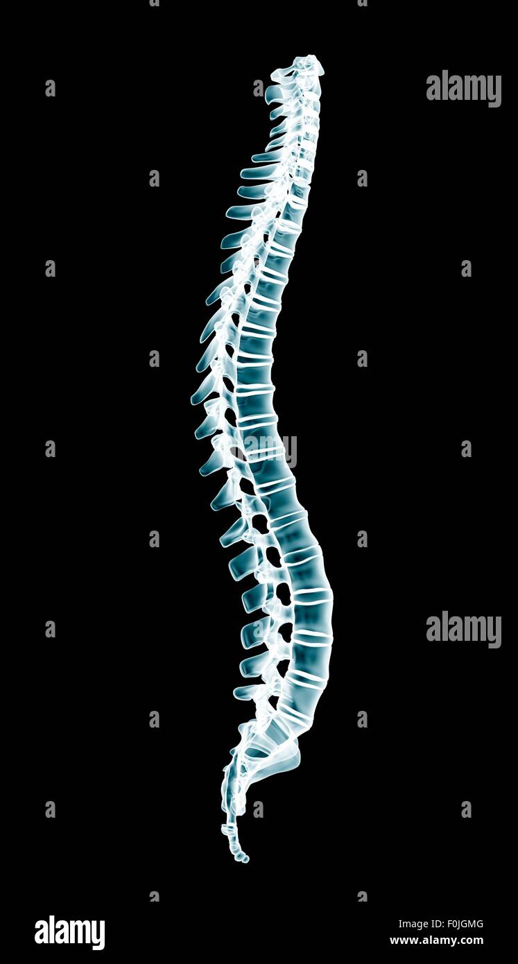 XRAY menschlichen Wirbelsäule auf schwarzem Hintergrund isoliert Stockfoto