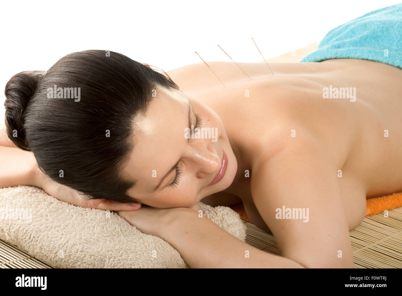 die sehr hübsche junge Frau auf Akupunkturbehandlung, horizontale Porträt Stockfoto