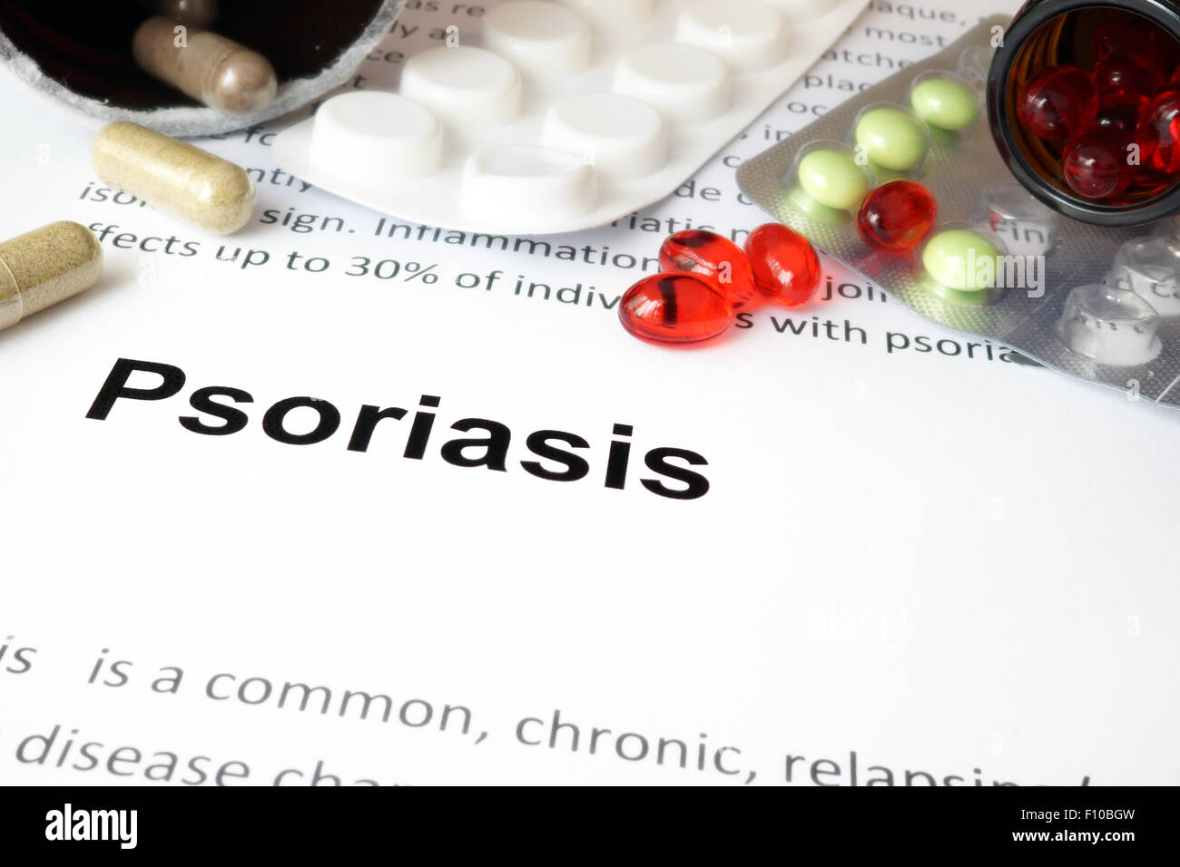 Papier mit Psoriasis-Therapie und Pillen. Medizinisches Konzept. Stockfoto