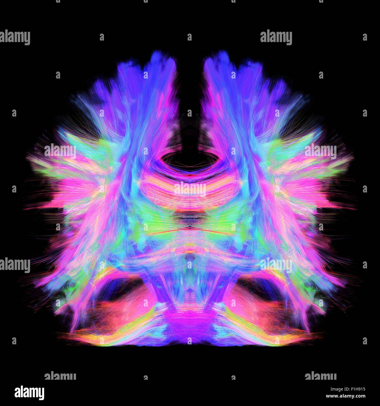 Vollständige Gehirn Traktographie künstlerische Farbe. Das ist voll Gehirn tracking kommenden Höchstauflösung Wiederaufbau 0,6 Kubikmeter mm anzeigen Stockfoto