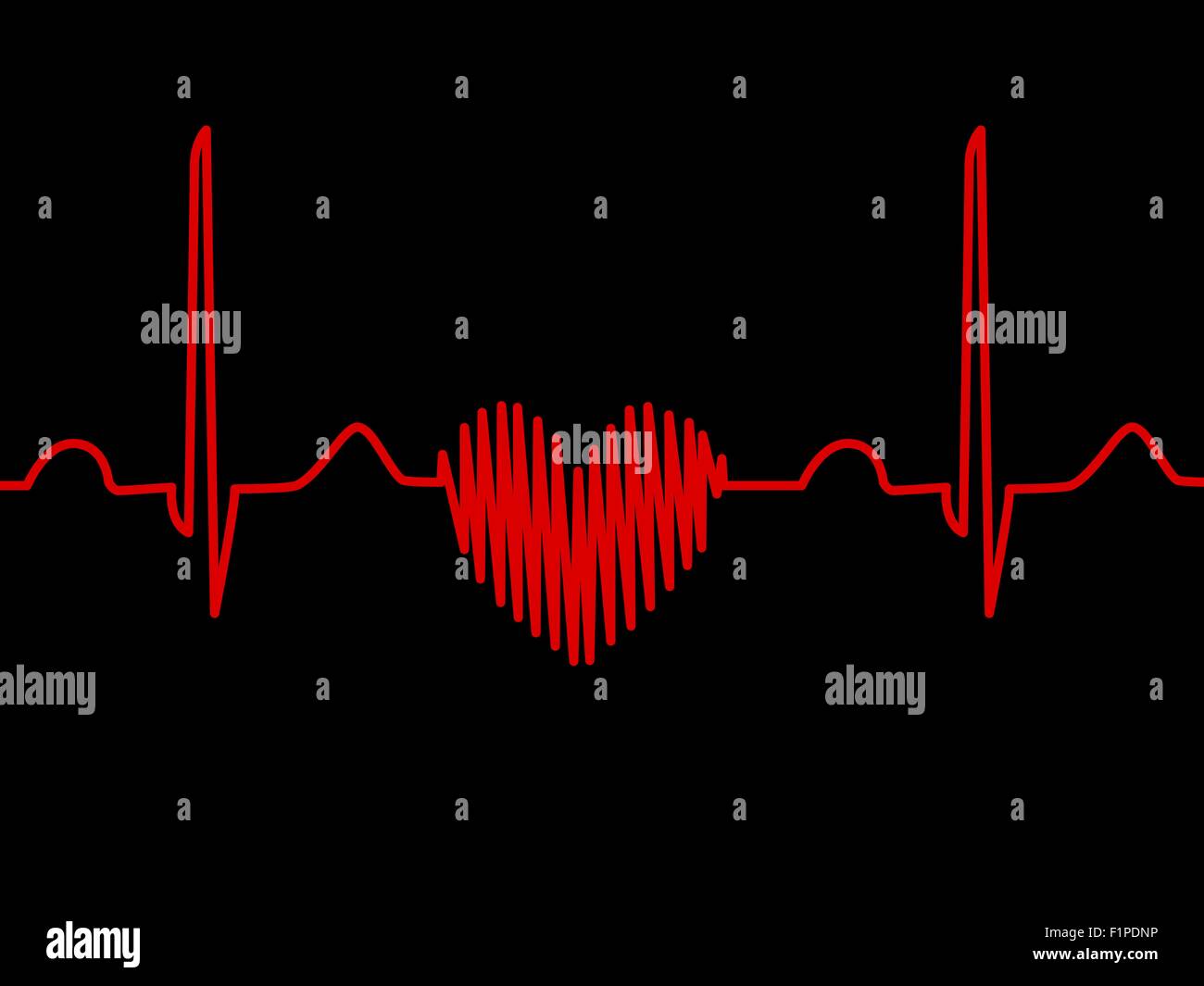 Computer Grafik einer herzförmigen Elektrokardiogramm (EKG)-Ablaufverfolgung. Eine EKG misst die elektrische Aktivität des Herzens. Stockfoto