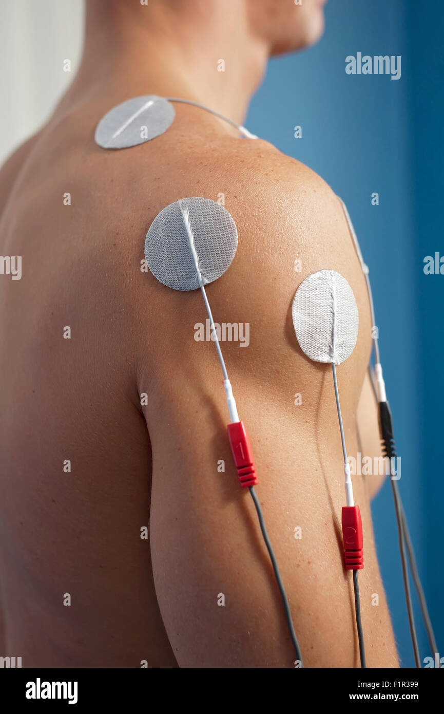 Behandlung von einem männlichen Patienten Schulter mit überlagerten, transkutane, elektrische Stimulation. Stockfoto