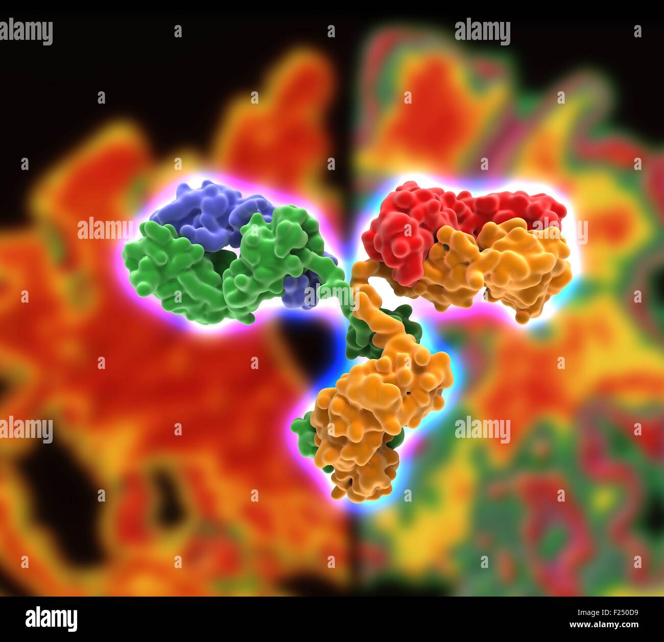 Computer-Grafik Darstellung einer Antikörper-Alzheiimer Behandlung. Dargestellt ist ein monoklonaler Antikörper, der wirkt auf das Nervensystem und eventuell möglichen therapeutischen Wert für die Behandlung der Alzheimer-Krankheit Amyloid Gehirn Plaque zu senken. Im Hintergrund verarbeitet ein Computer vertikalen (koronalen) Schnitt durch das Gehirn eines Alzheimer-Patienten (links) im Vergleich mit einem normalen Gehirn (rechts). Stockfoto