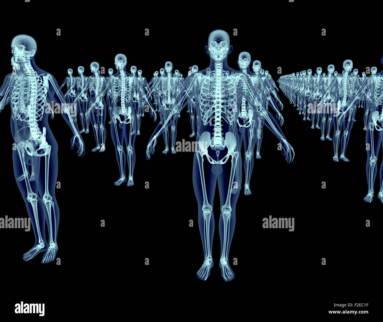 Menge von Xray Skelette isoliert auf schwarz Stockfoto