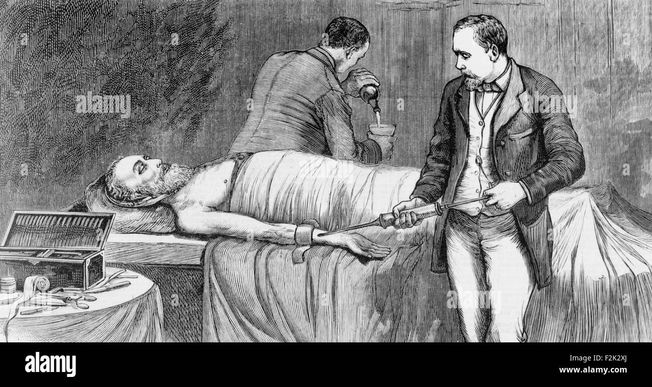 Den Körper des verstorbenen Präsidenten James Garfield - 20. September 1881 Einbalsamierung Stockfoto