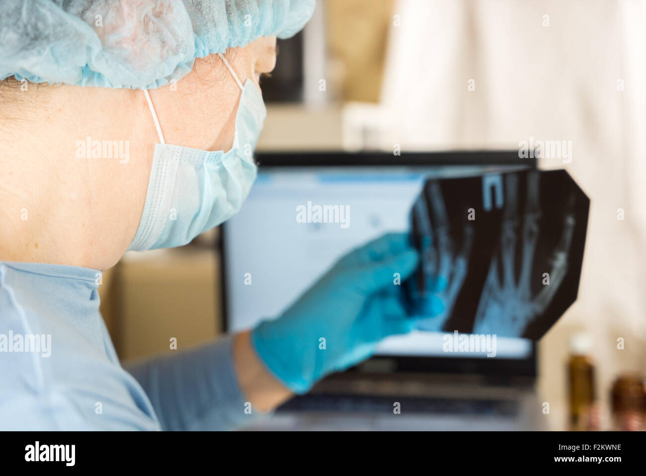 Eine Ärztin blickt auf eine Röntgenaufnahme Stockfoto