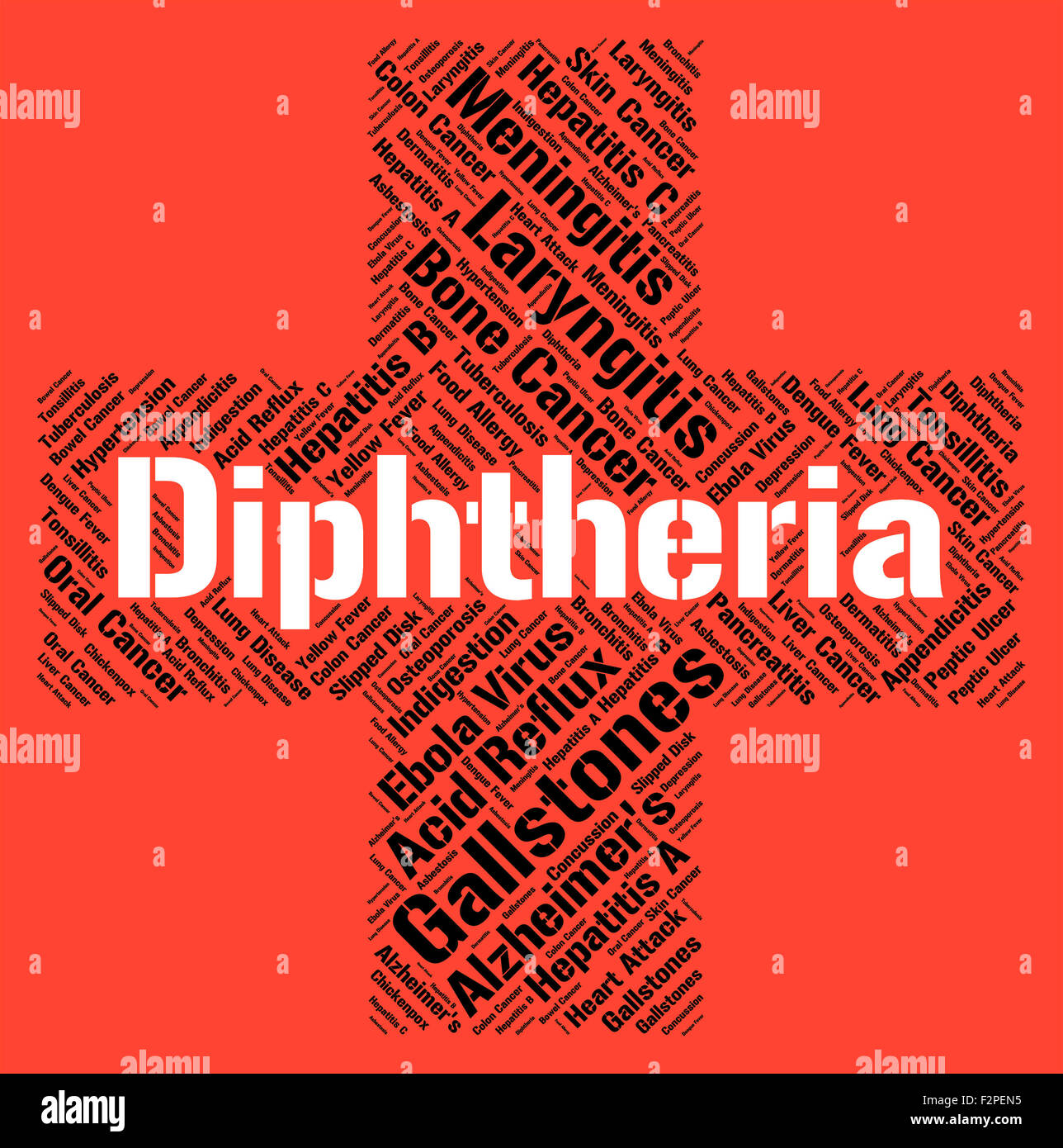 Diphtherie-Wort Angabe Corynebacterium Diphtheriae und Bakterien Stockfoto