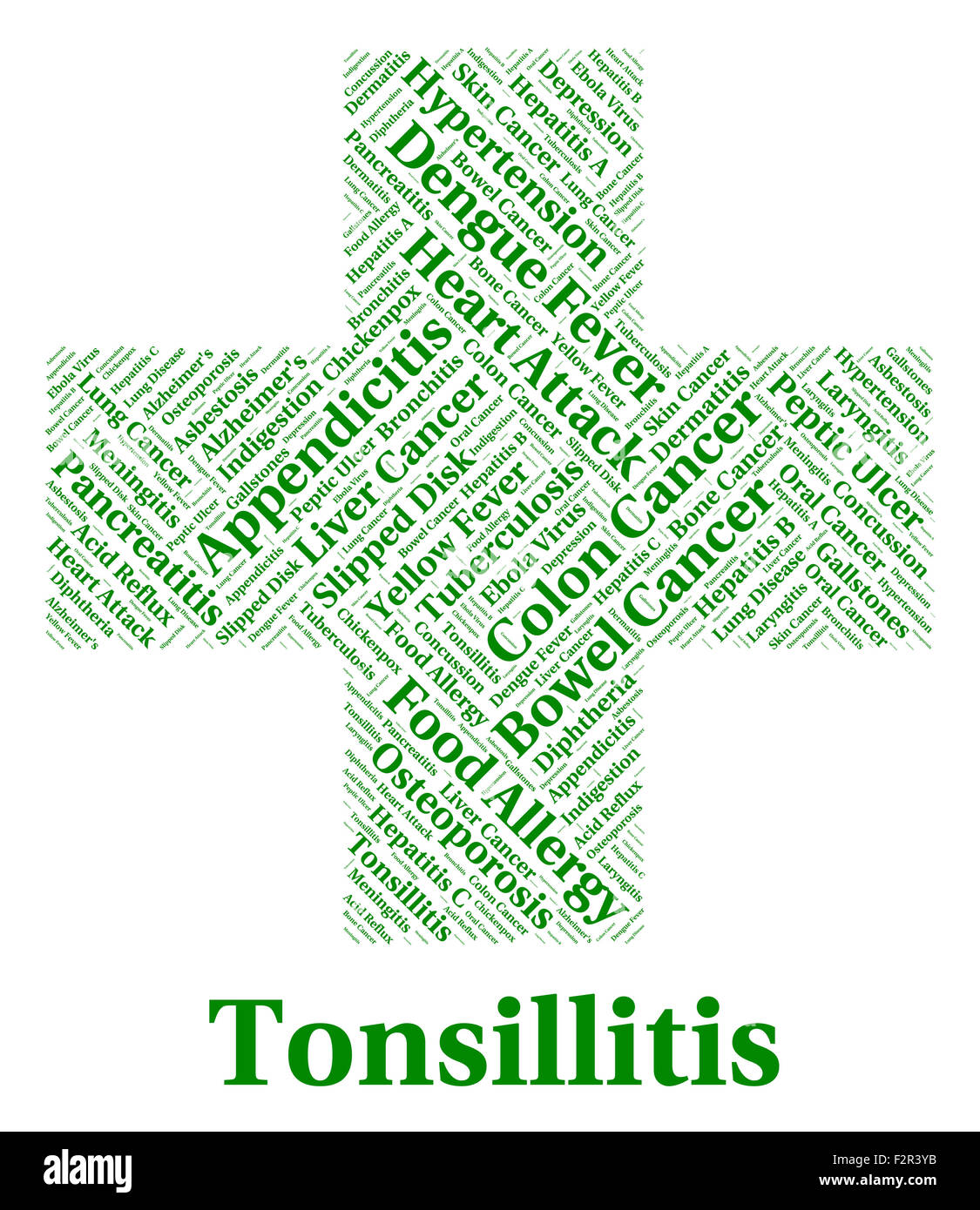 Mandelentzündung Krankheit darstellt, Halsentzündung und Unwohlsein Stockfoto