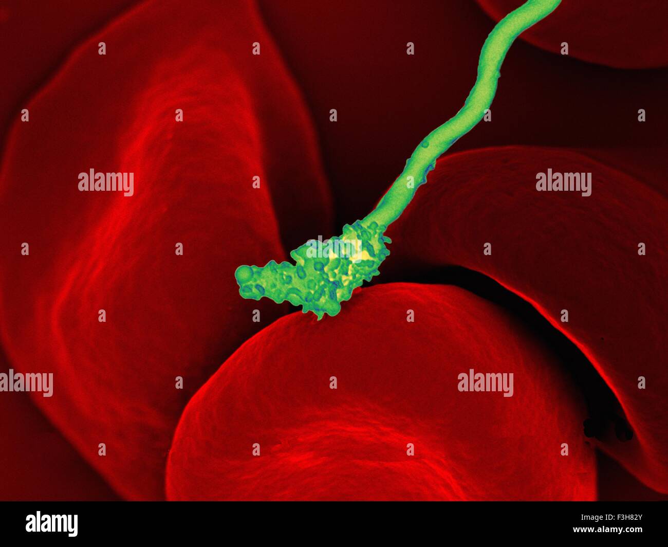 SEM Borrelien Borelia Bakterium roten Blutkörperchen Stockfoto