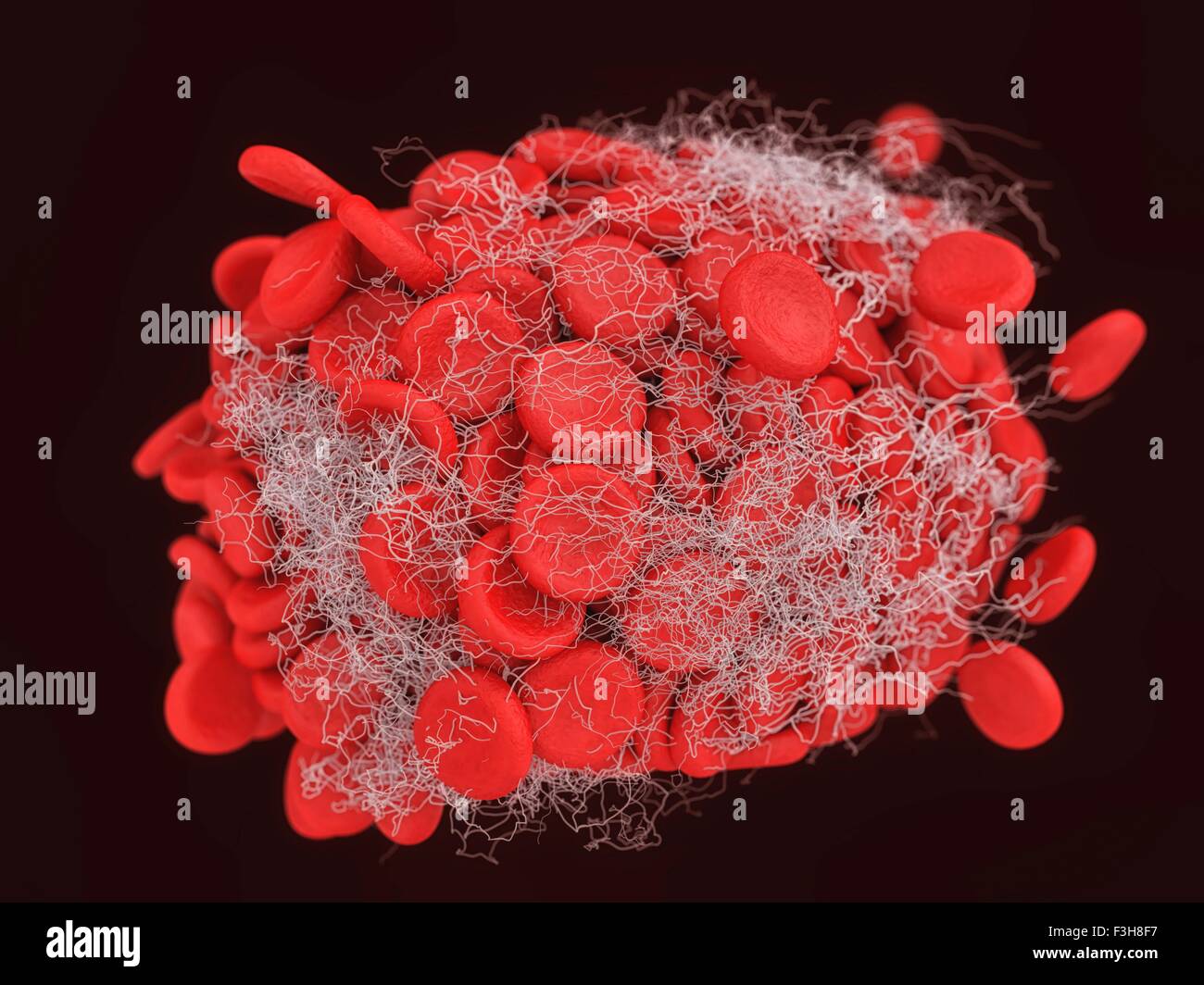 Abbildung eines Blutgerinnsels zeigt ein Büschel von roten Blutkörperchen miteinander verflochten in einem Fibrin-Netz Stockfoto