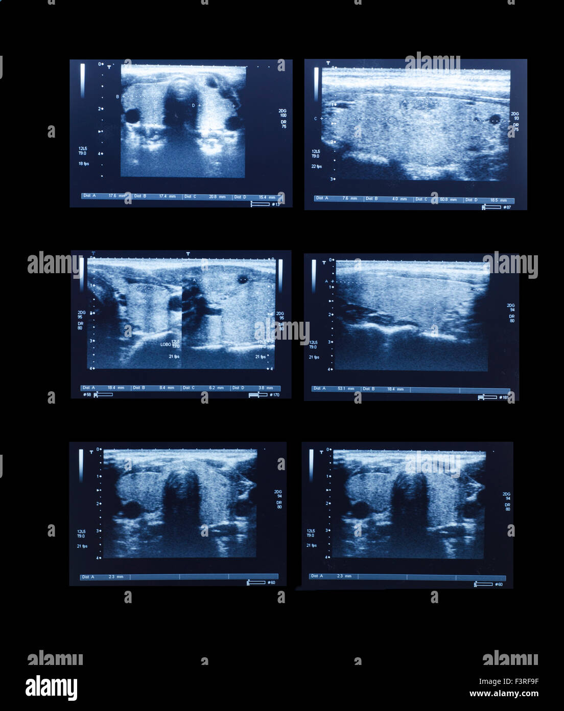 Sonographie Oberbauch ärztliche Untersuchung für das Gesundheitswesen Stockfoto