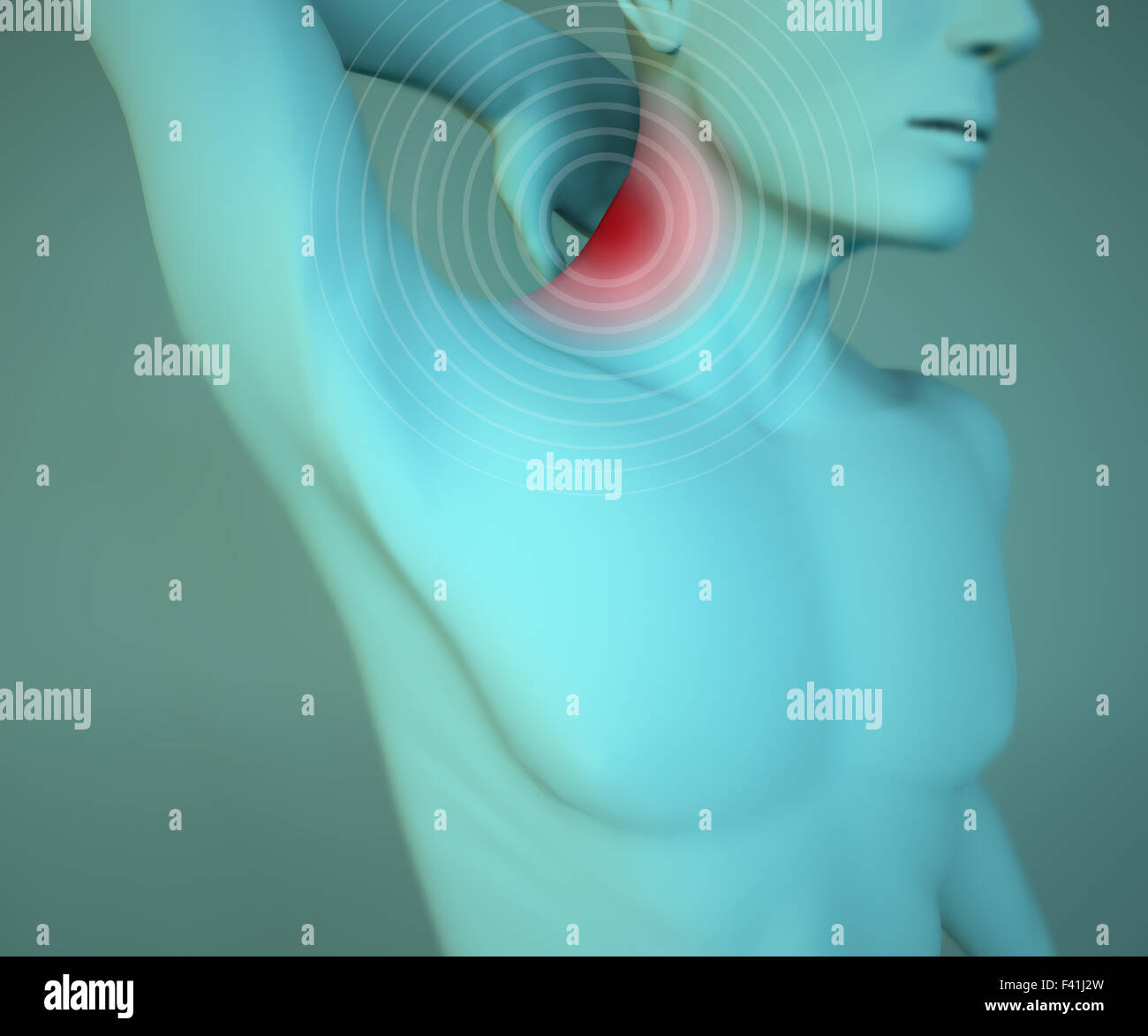 Menschlichen Körper mit Schmerzen im Nacken und rot hervorgehoben Stockfoto