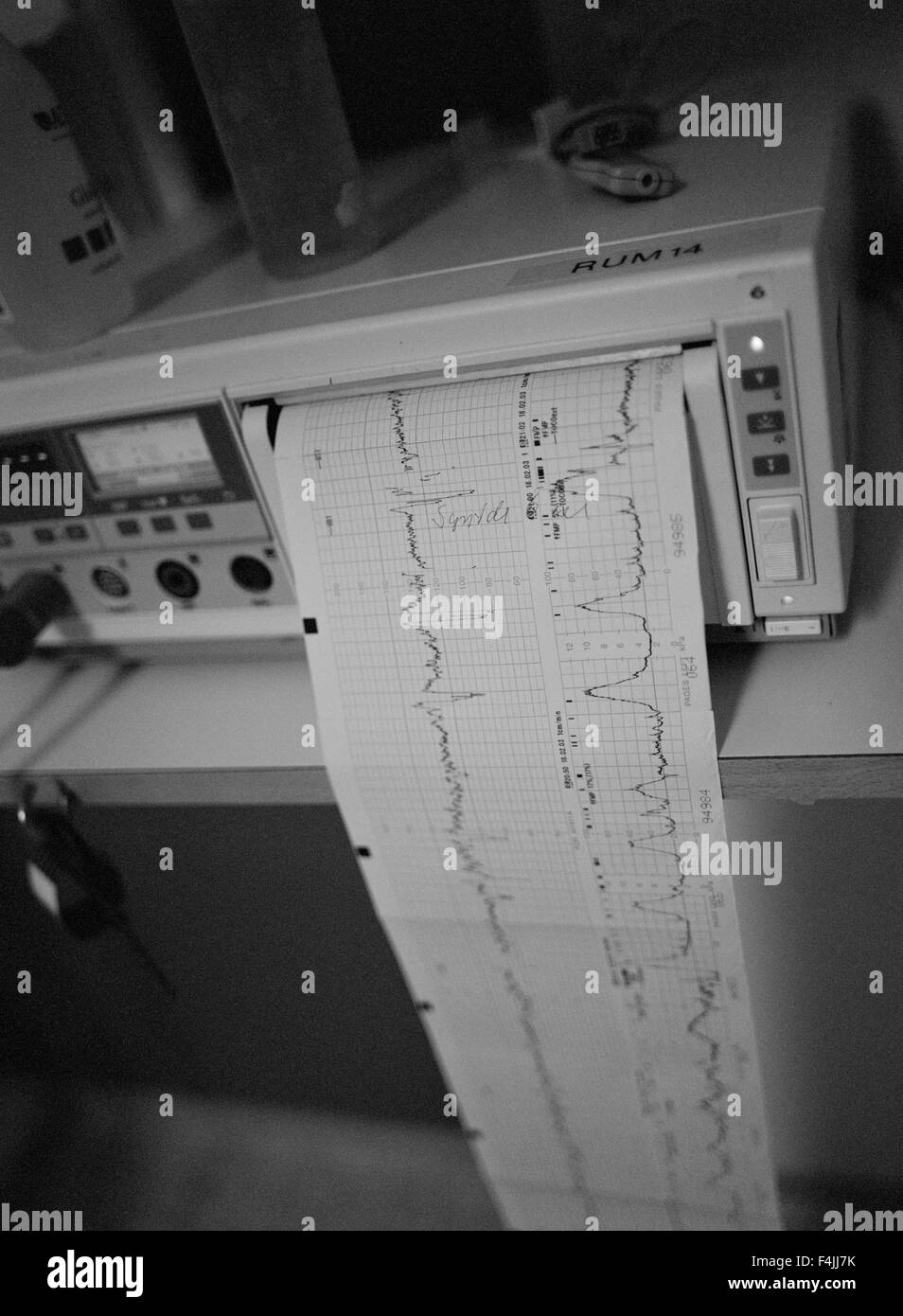 Graphische Aufzeichnung der Herzzyklus produziert von EKG Stockfoto