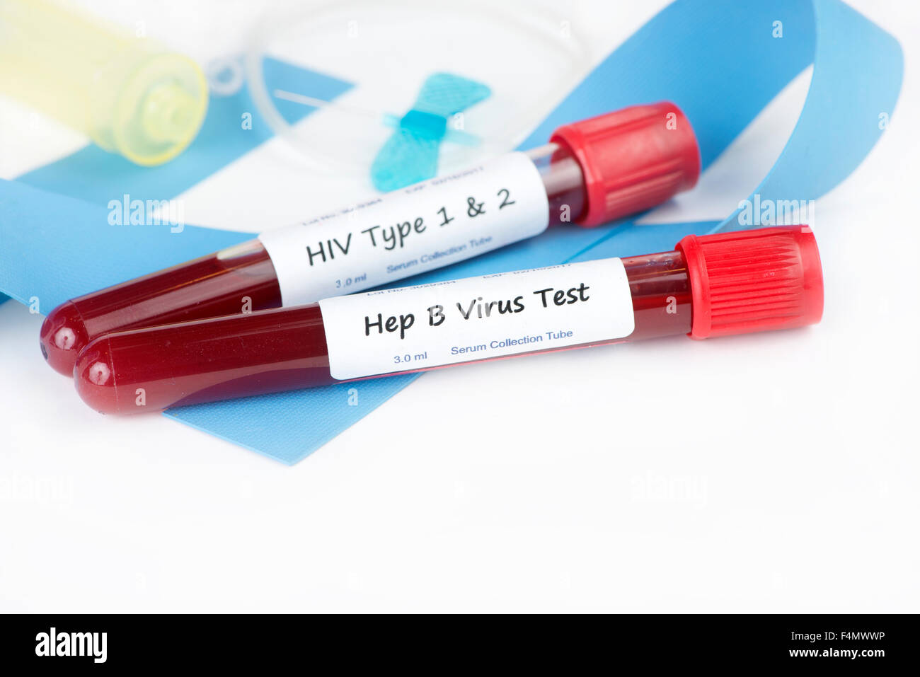 HIV Typ 1 und 2 und Hepatitis B Blutentnahmeröhrchen mit Schmetterling Katheter und Band. Stockfoto