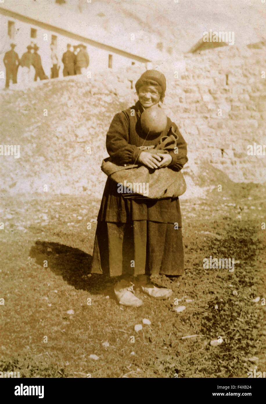 Eine Bäuerin mit eine riesige Zyste Stockfoto