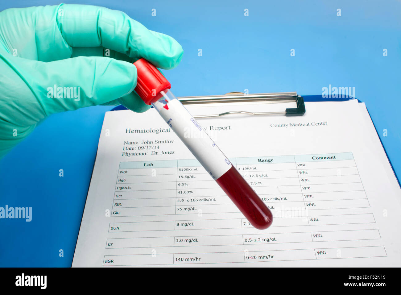 Medizintechniker hält Hämatologie Lab Panel Blut Probenröhrchen mit Patienten Hämatologie-Bericht. Stockfoto