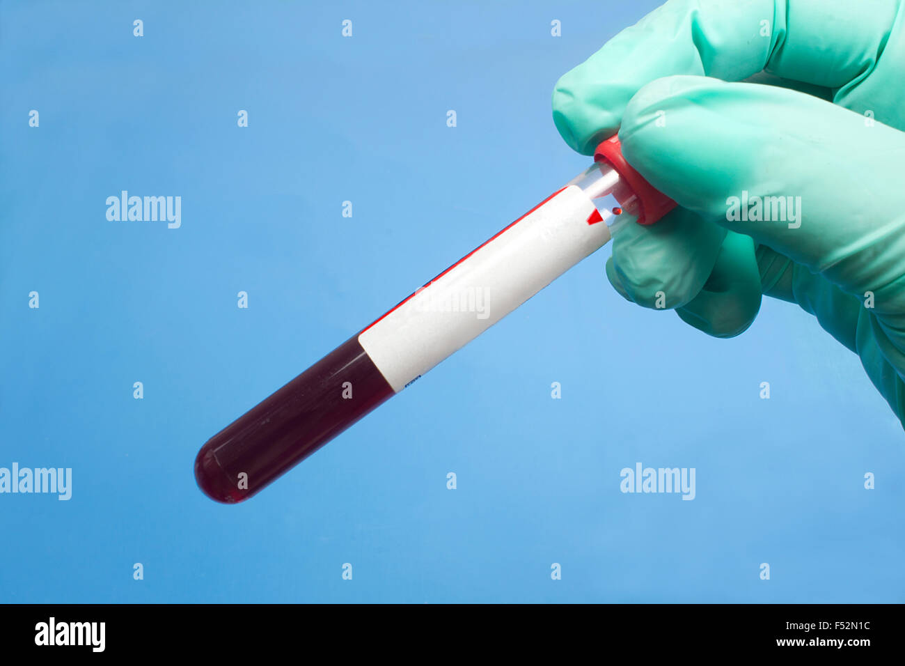 Techniker hält Labor Blut Panel Probenröhrchen Test. Stockfoto
