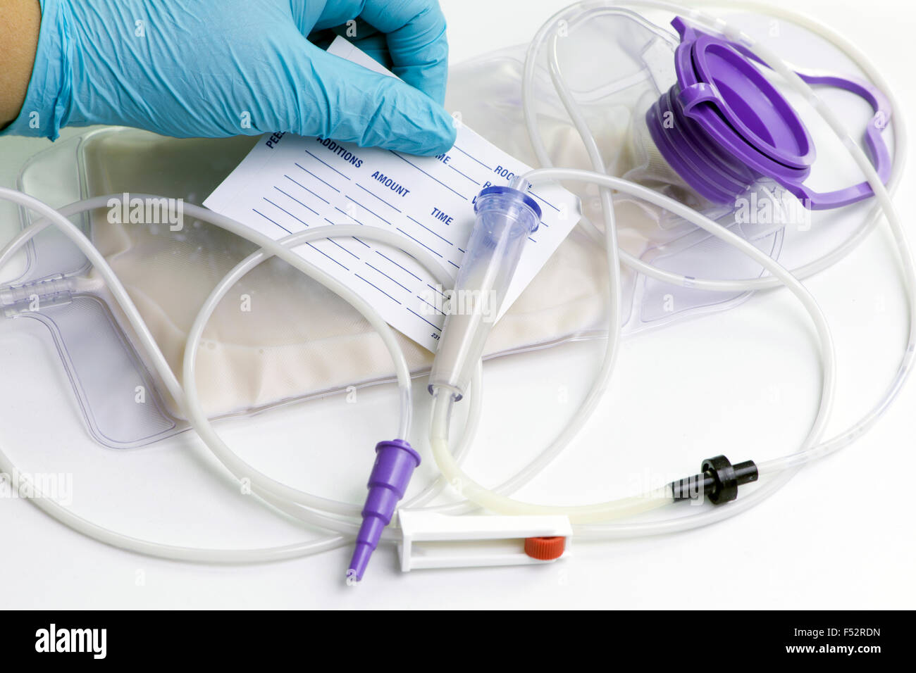 Krankenschwester stellen Patienten Namensschild auf enterale Ernährung Tasche. Stockfoto