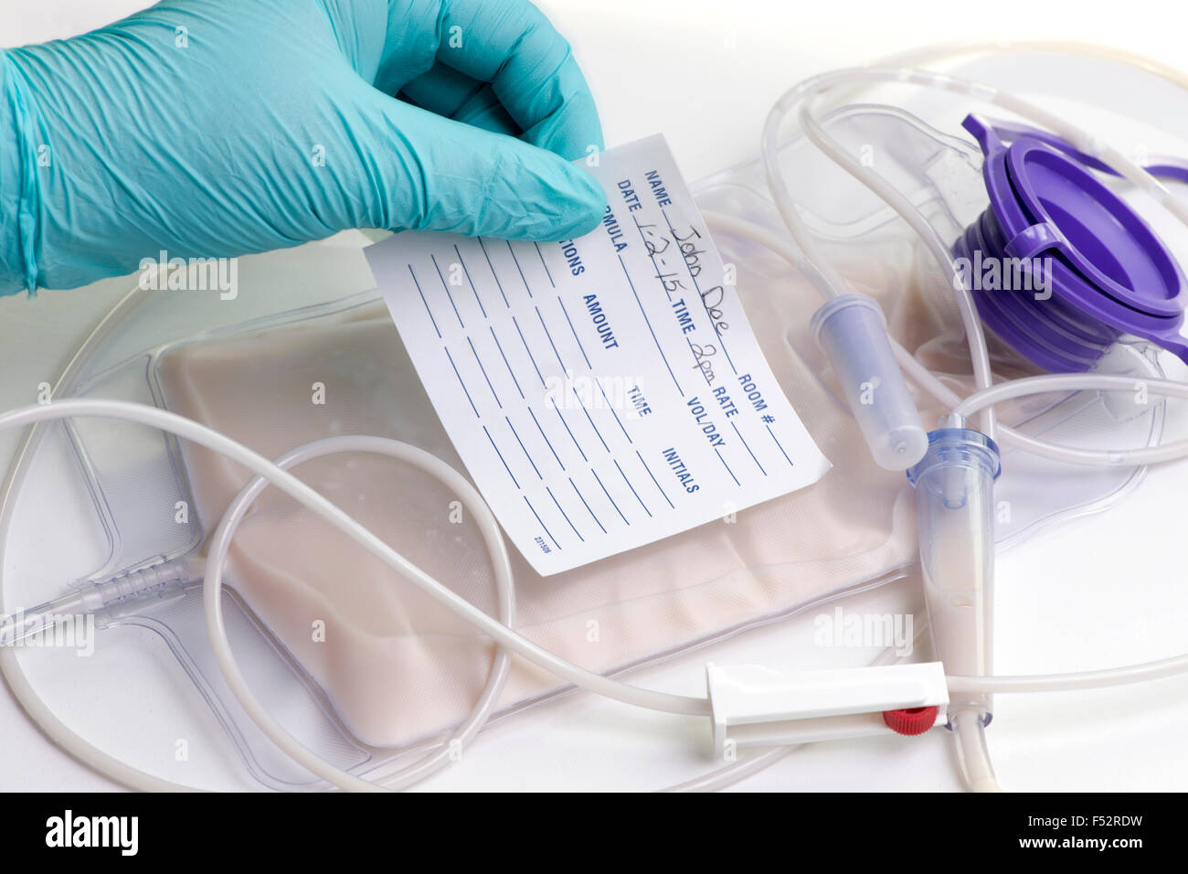 Krankenschwester stellen Patienten Namensschild auf enterale Ernährung Tasche. Stockfoto