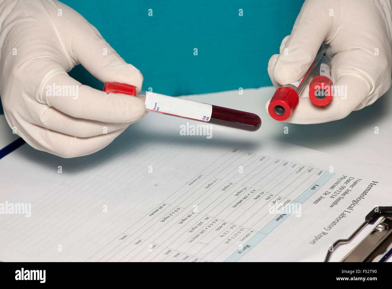 Labortechniker hält Blutprobe mit leeren Etiketten und Labor Bericht. Stockfoto