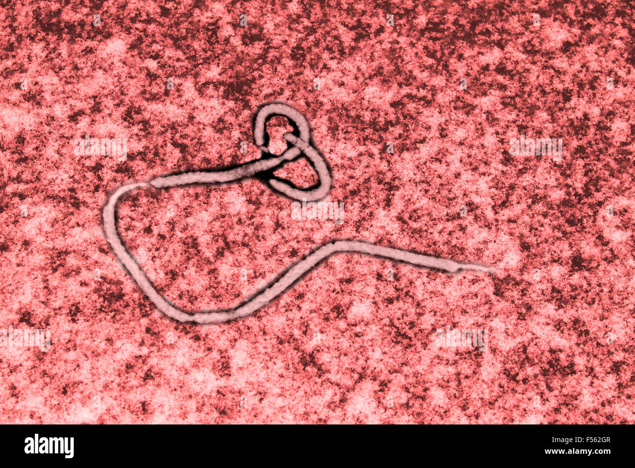 Ebola-Virus unter dem Mikroskop epidemischen Schild gesehen Stockfotografie