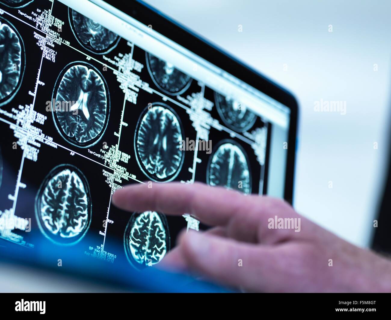 Arzt eine Reihe von MRI (Magnetic Resonance Imaging)-Gehirn-Scans auf einem Bildschirm anzeigen Stockfoto