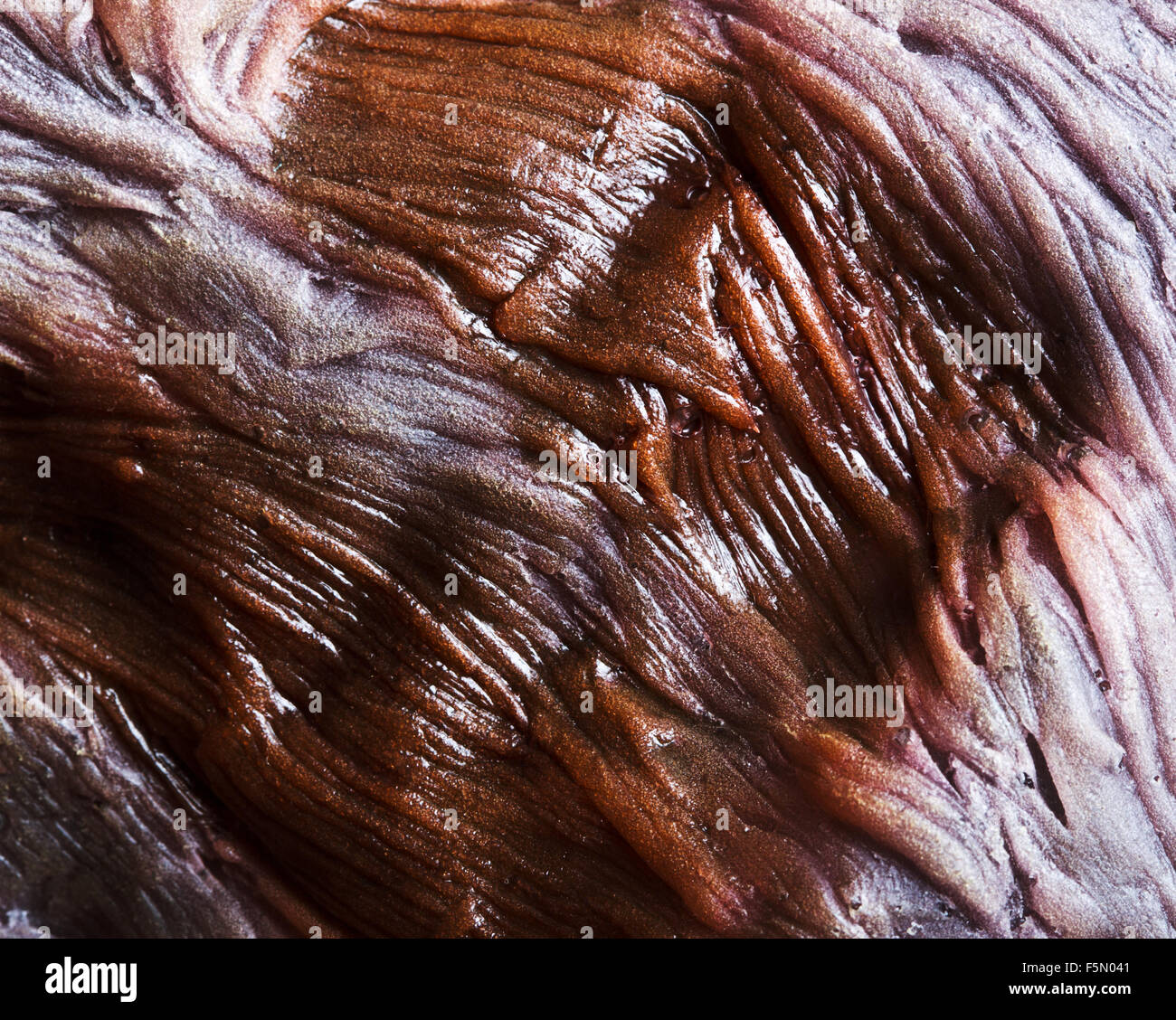 Nahaufnahme der verbrannten menschlichen Haut Stockfoto