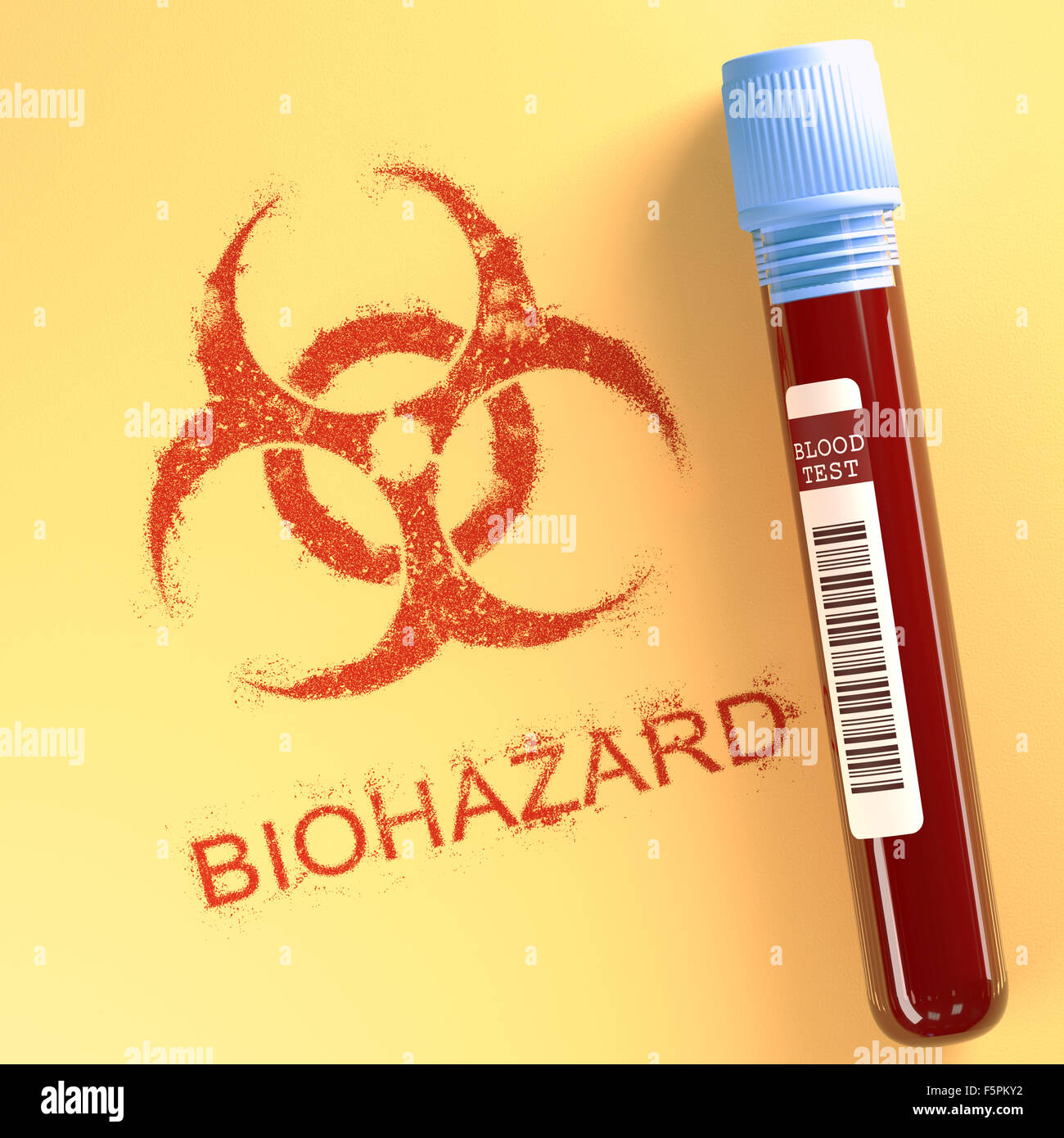 Reagenzglas mit kontaminiertem Blut, Abbildung. Stockfoto