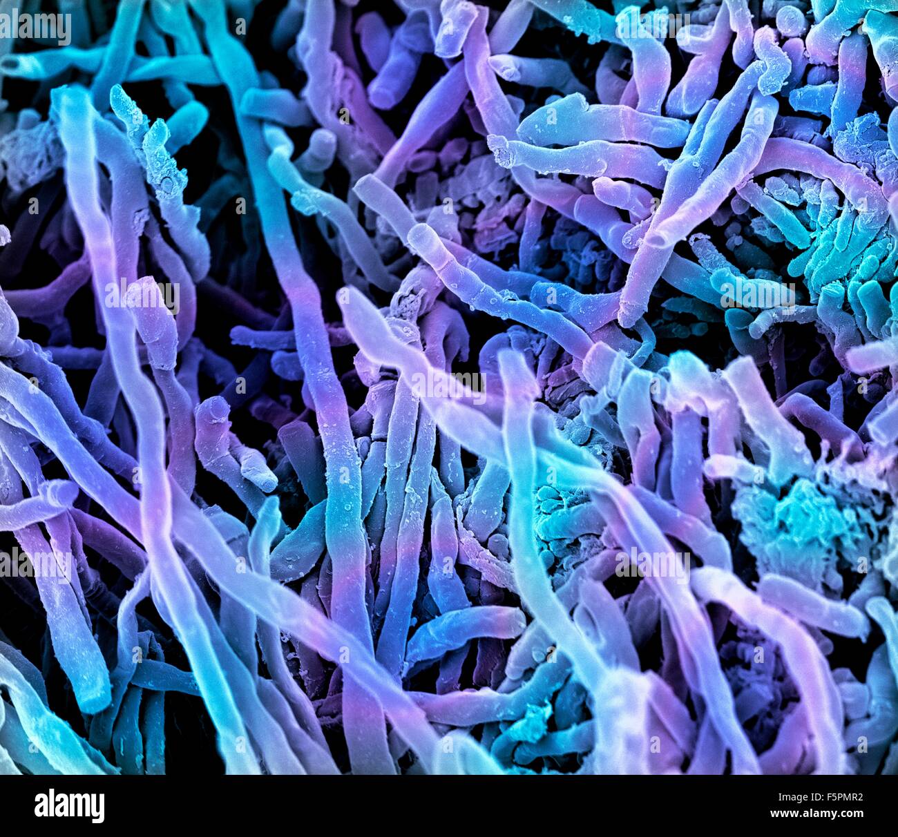 Streptomyces Coelicoflavus Bakterien. Farbige scanning Electron