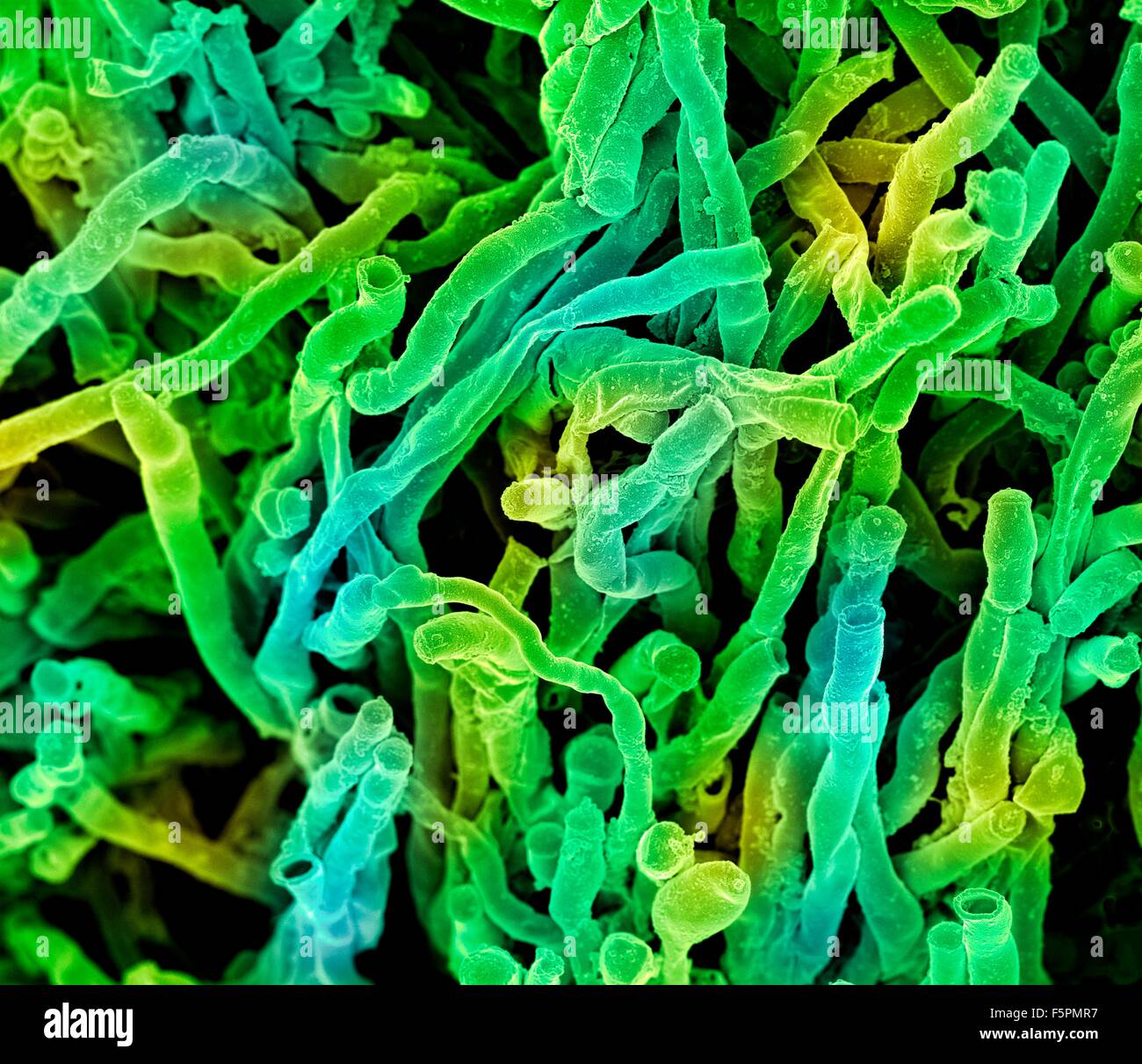 Actinomyces Viscosus Stockfotos und bilder Kaufen Alamy