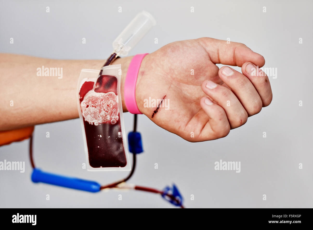 Detail mit der Hand ein Blutspender und Kunststoff Blutbeutel in einem Krankenhaus Stockfoto