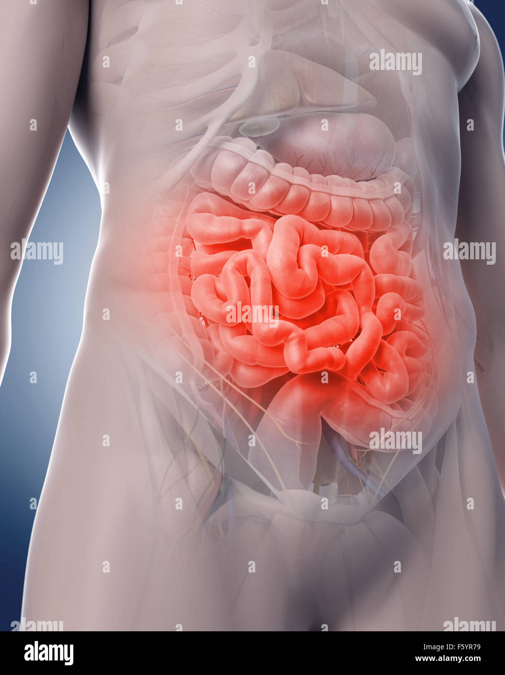 medizinische 3d Illustration der schmerzhaften Darm Stockfoto