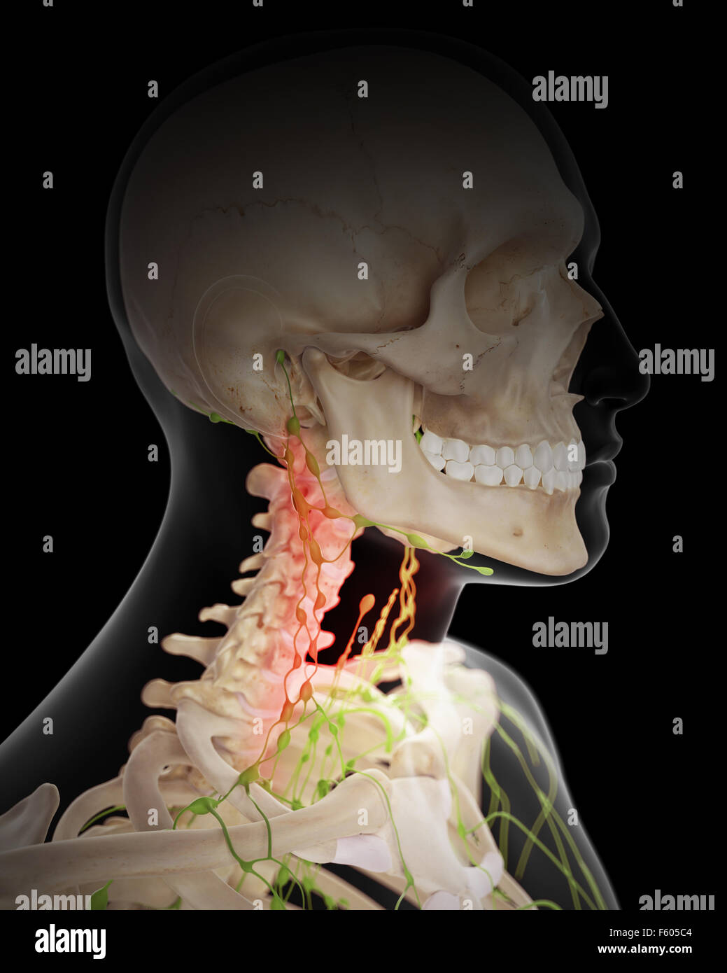 medizinisch genaue Abbildung - schmerzhafte Lymphknoten Stockfoto