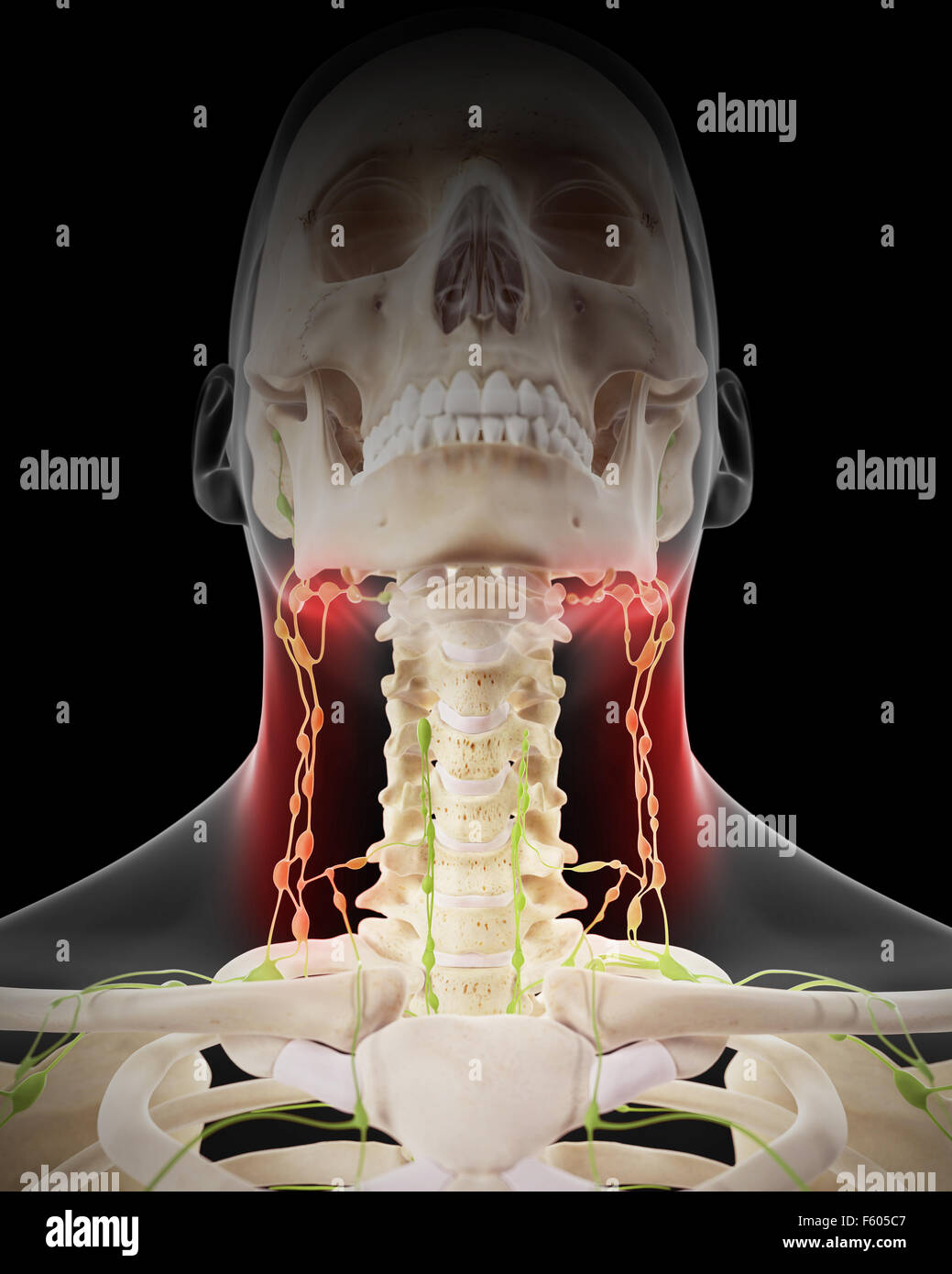 medizinisch genaue Abbildung - schmerzhafte Lymphknoten Stockfoto