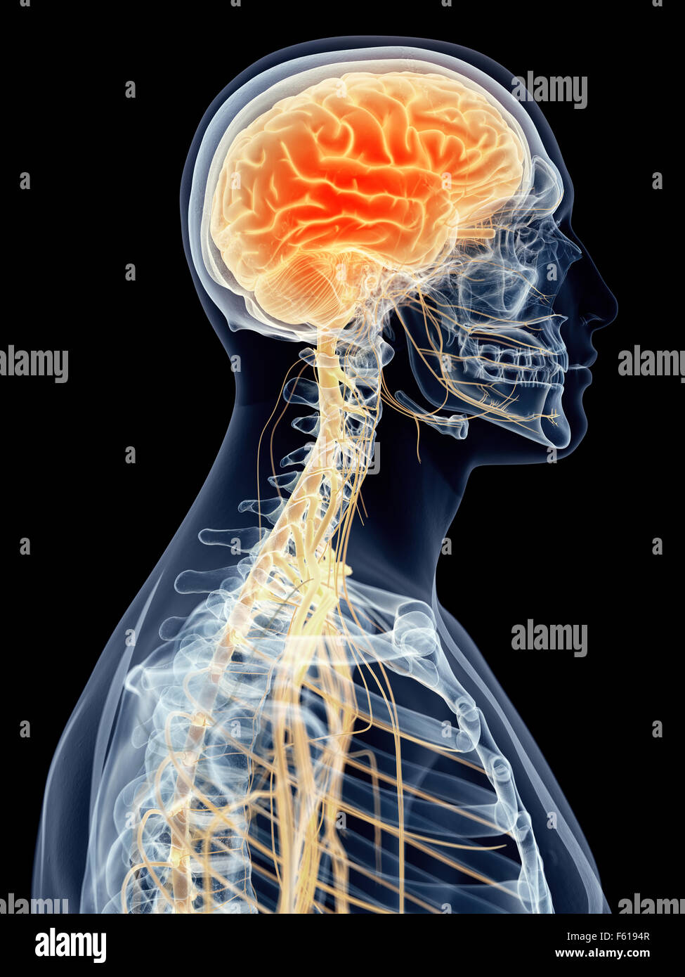 medizinisch genaue Abbildung - Kopfschmerzen Stockfoto