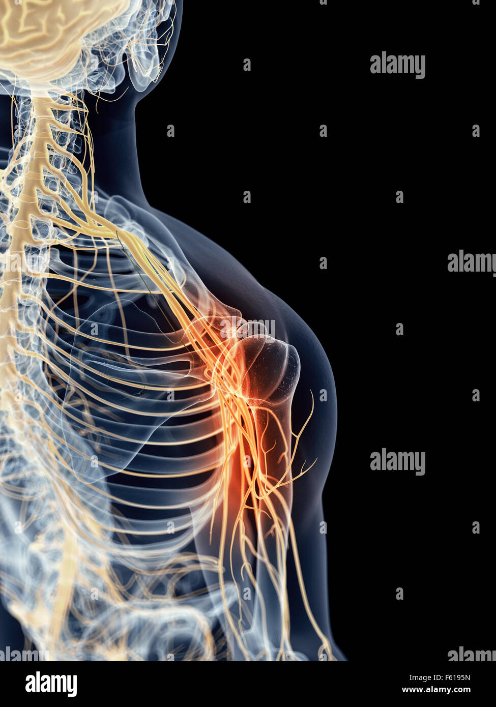 medizinisch genaue Abbildung - schmerzende Schulter Nerven Stockfoto