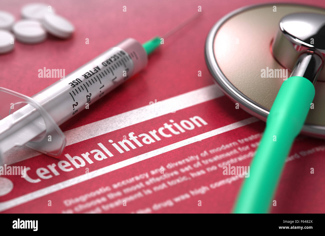 Hirninfarkt - medizinisches Konzept mit Text verschwommen, Stethoskop, Pillen und Spritze auf roten Hintergrund. Selektiven Fokus. Stockfoto